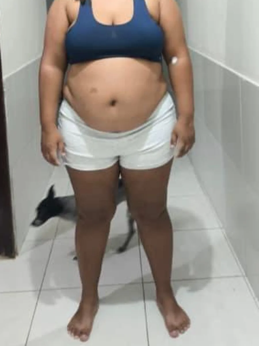Paciente antes